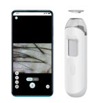 Rootli Scope AI-Connected Scalp & Follicle Analyzer
