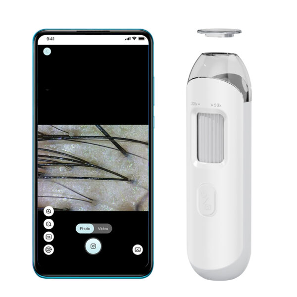 Professional HD Scalp & Skin Analyzer: Handheld USB Digital Microscope for Salon & Home Use